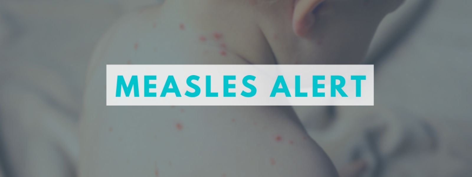 Resurgence of Measles Sparks Concern in Sri Lanka